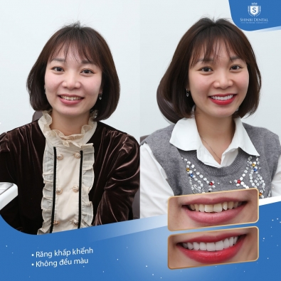 Khách hàng Hoàng Thị Nhung